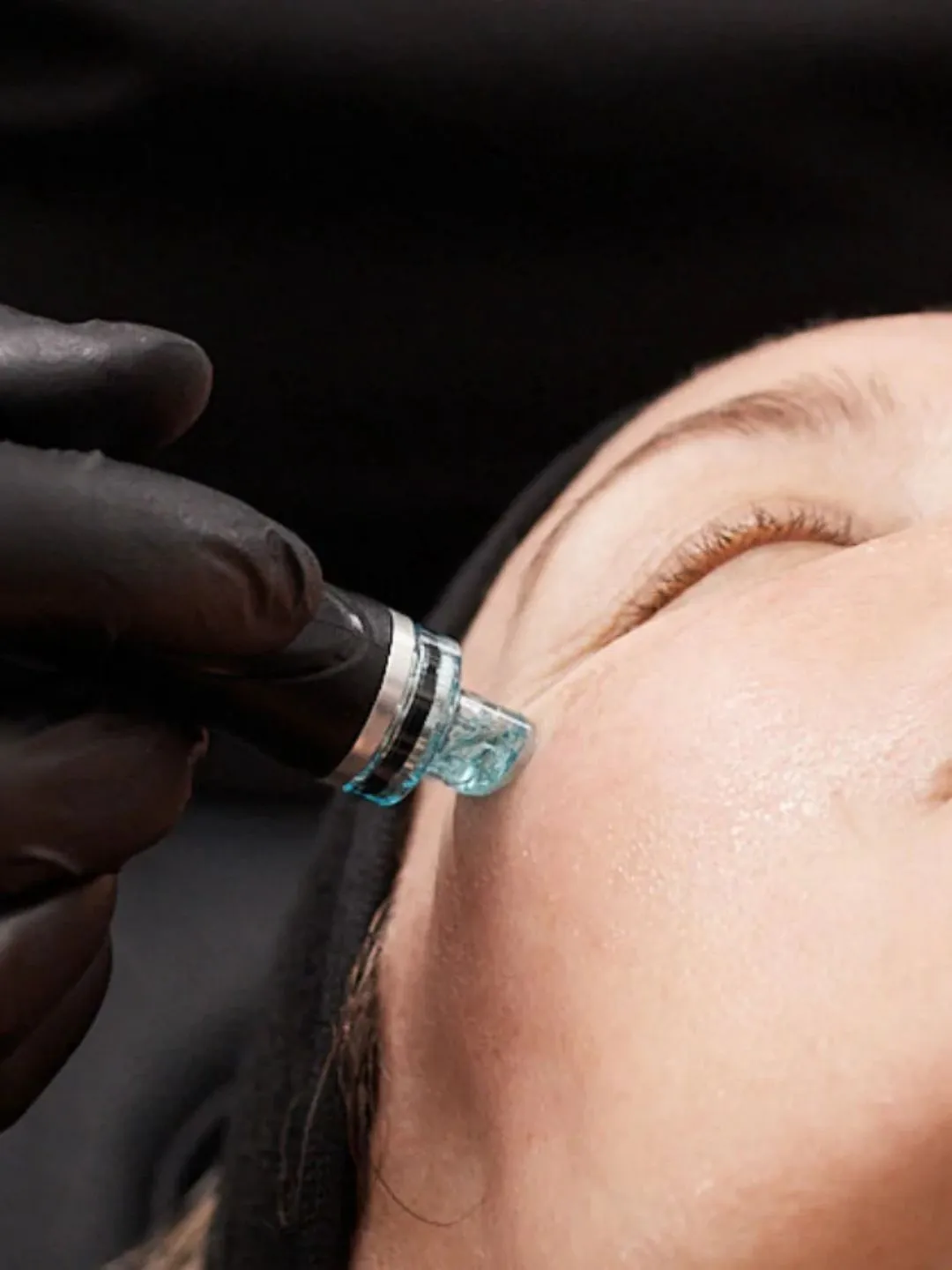 HydraFacial en Ciutadella de Menorca