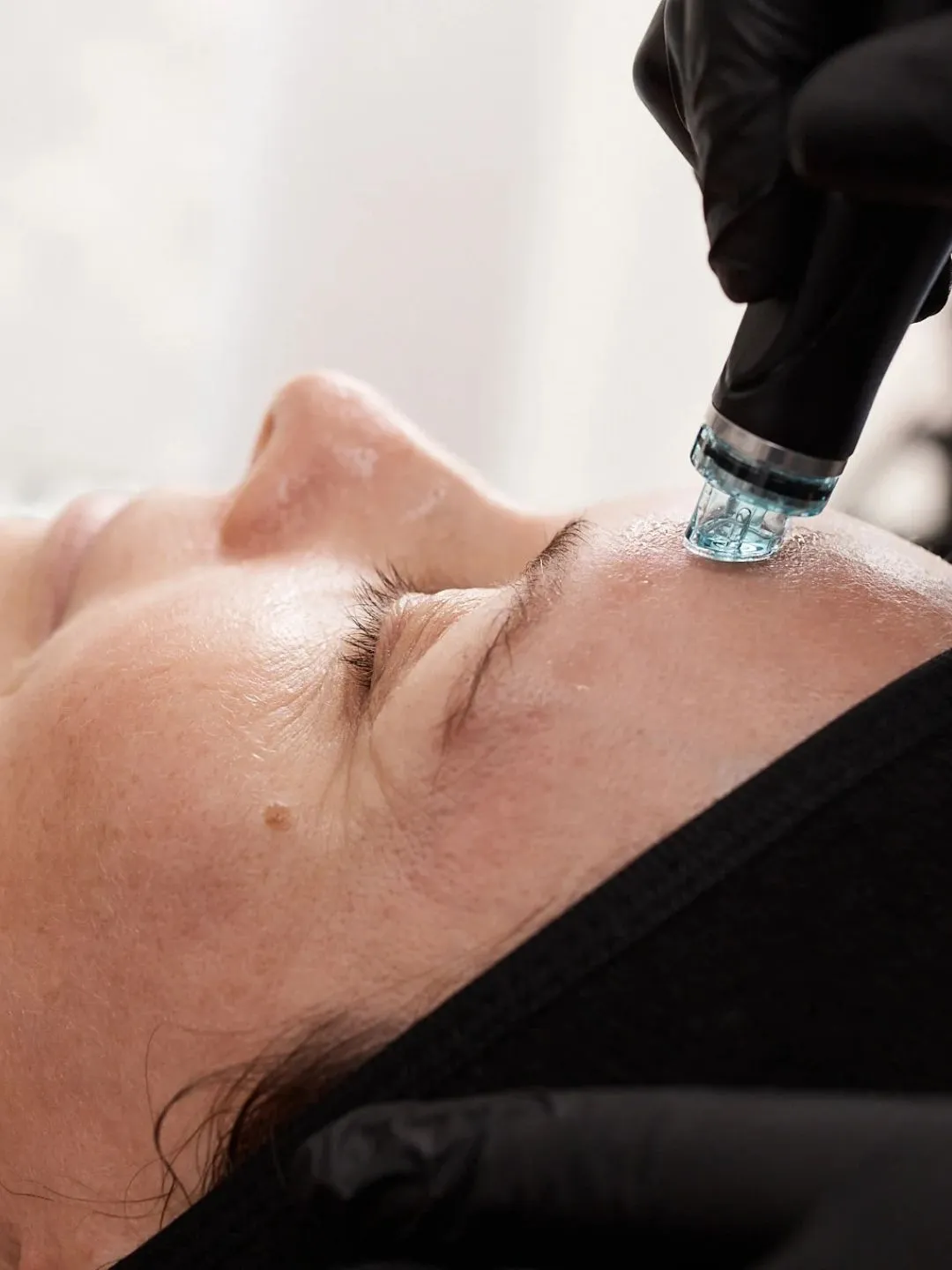 HydraFacial en Ciutadella de Menorca
