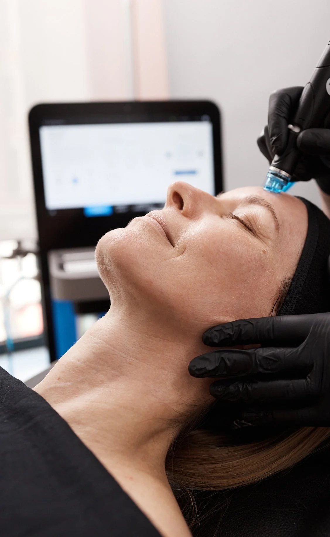 HydraFacial en Ciutadella de Menorca